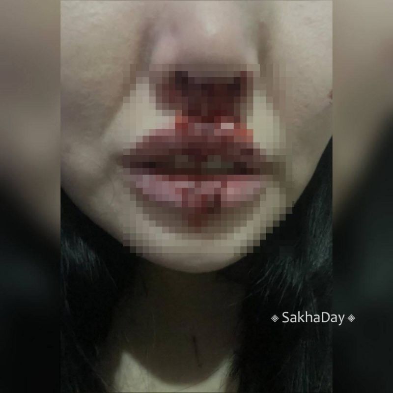 ���������� ������� ����������� ��������, ���������� �� ���