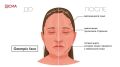 Как отсрочить старение и сохранить здоровье: советы эндокринолога
