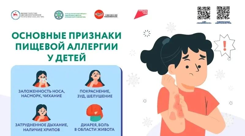 Пищевая аллергия: как распознать и что делать?