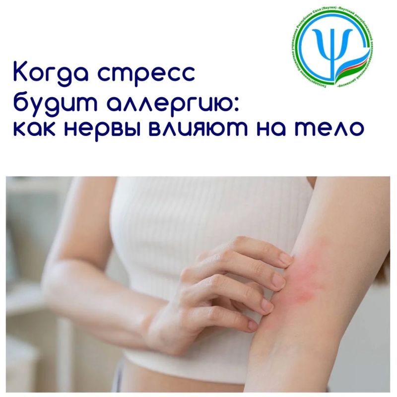 Когда стресс будит аллергию: как нервы влияют на тело